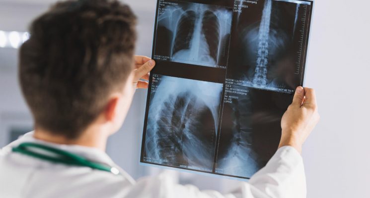 Conheça as vantagens de ser um tecnólogo em radiologia