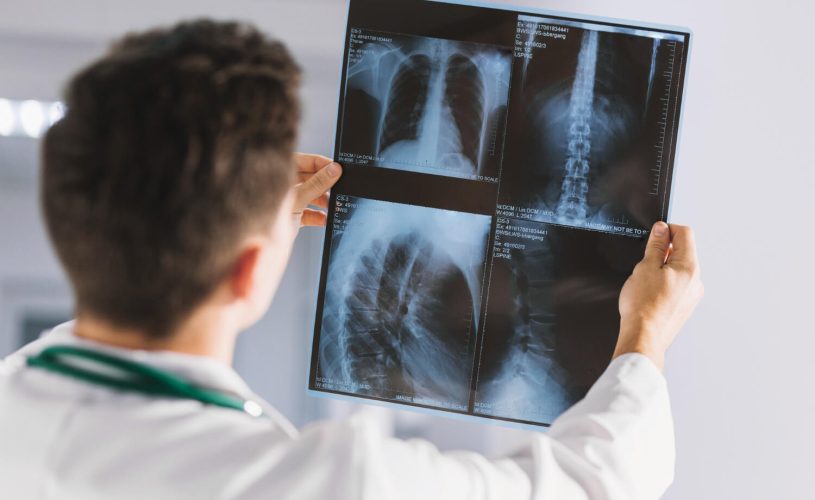 Conheça as vantagens de ser um tecnólogo em radiologia