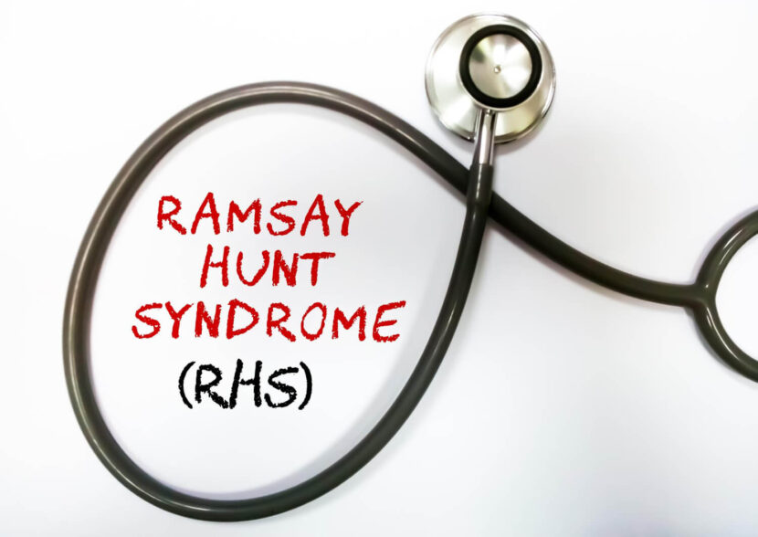 Síndrome de Ramsay Hunt