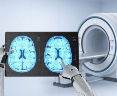 O impacto da Inteligência Artificial na Radiologia