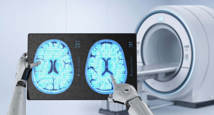 O impacto da Inteligência Artificial na Radiologia