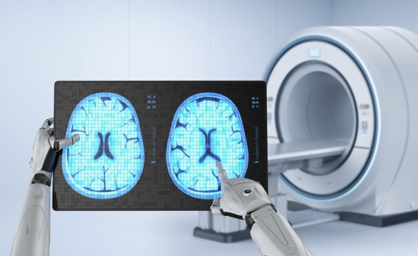 O impacto da Inteligência Artificial na Radiologia