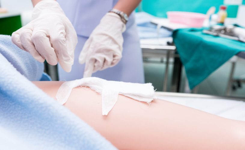 Conheça os motivos para especializar-se na área de Enfermagem em Estomaterapia
