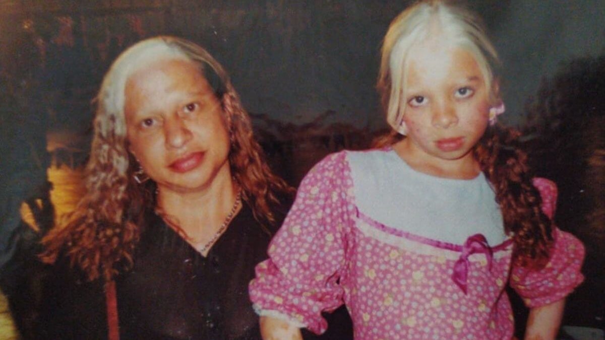 Mãe e filha nascem com a mesma mecha branca no cabelo e chamam a atenção:  “É um elo”